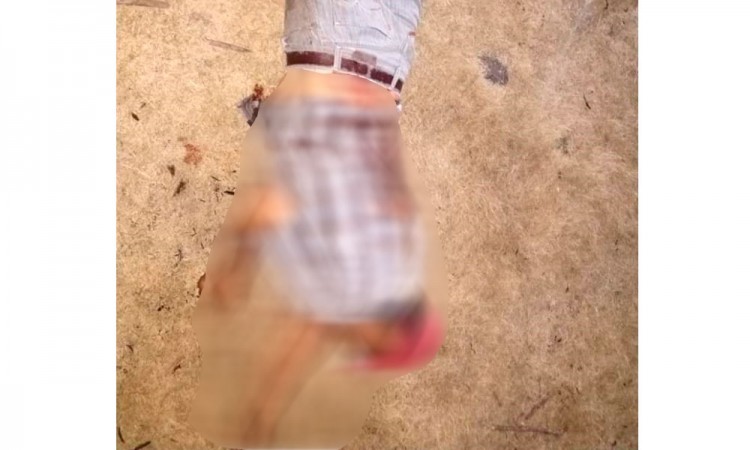 Encuentran a hombre con impactos de bala en Chietla