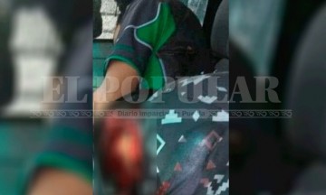 Acribillan a dos hombres en pleno centro de San Felipe Hueyapa