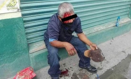 Golpean a presunto ladrón de baterías de coches en Izúcar