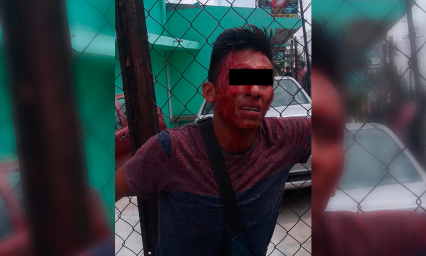 Golpean a ratero de Xochimehuacan