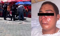 Golpean brutalmente a joven de 17 años y lo llevan al hospital