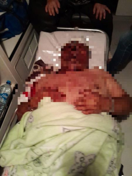 Periodista poblano Augusto Simón Valencia sufrió un intento de homicidio