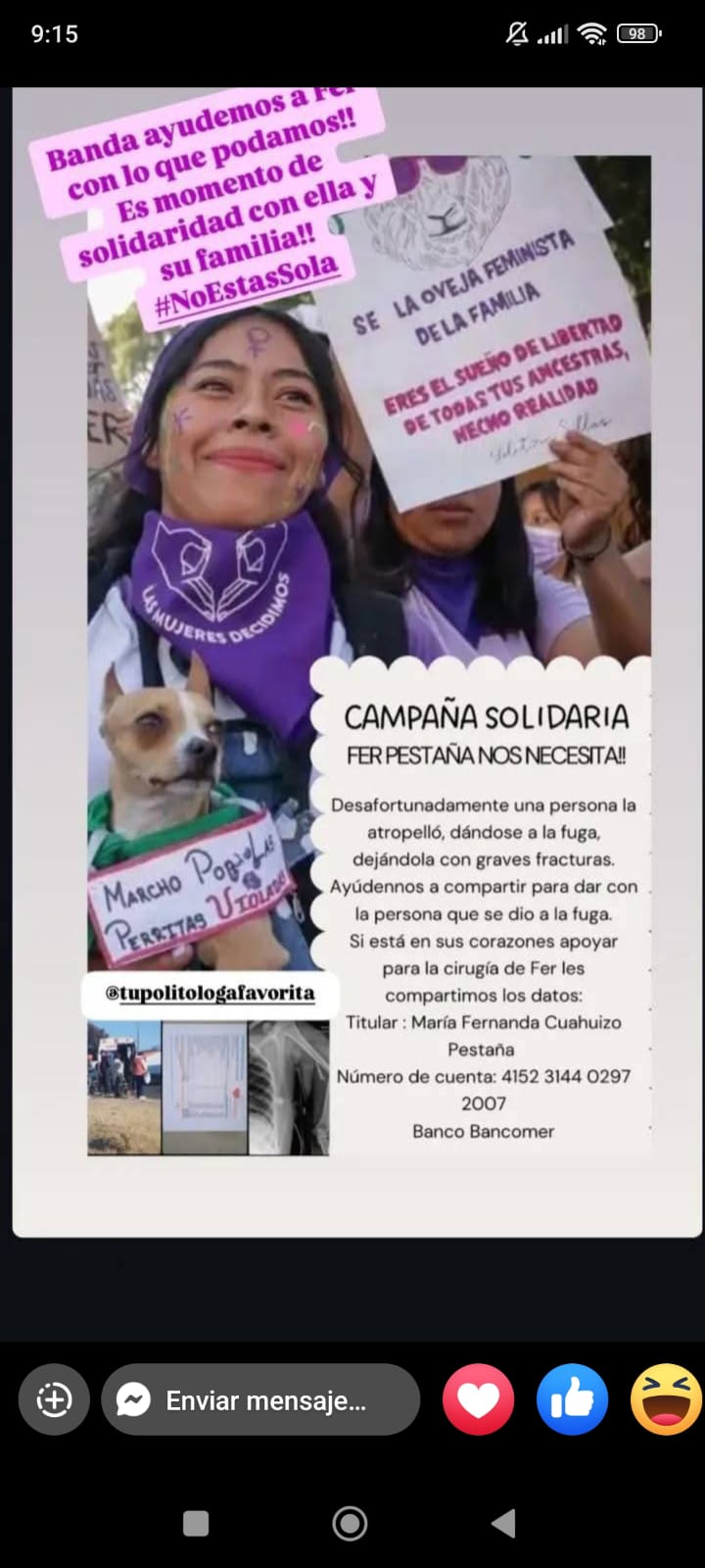 ¡Ayudemos a María Fernanda! Fue atropellada en Puebla y necesita una cirugía 