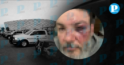 Fernando Jara de “El Fusil” denuncia agresión tras partido en el estadio Cuauhtémoc