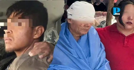 En Atlixco, sujeto en aparente condici&oacute;n de calle atac&oacute; con machete a un adulto mayor de 73 a&ntilde;os; fue detenido por la polic&iacute;a municipal