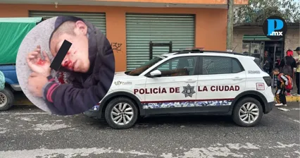  Retienen y golpean a presunto ladr&oacute;n en la colonia Miguel Hidalgo 