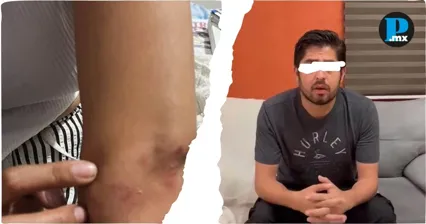Denuncia Nadia presunta agresi&oacute;n de su expareja mientras enfrenta tratamiento contra el c&aacute;ncer