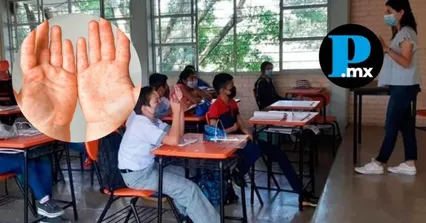 Regresa uso de cubrebocas en Tlaxcala por brote de sarampi&oacute;n; ya suman tres casos confirmados