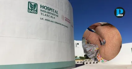 Pacientes con sarampi&oacute;n se concentran en municipios del sur de Tlaxcala, en colindancia con Puebla, durante la temporada de Semana Santa.